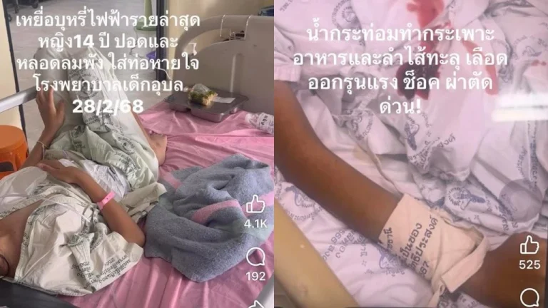 電子煙害少女肺衰竭 卡痛飲料致少年胃穿孔